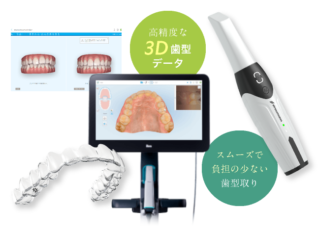 高精度な3D歯型データ　スムーズで負担の少ない歯型取り