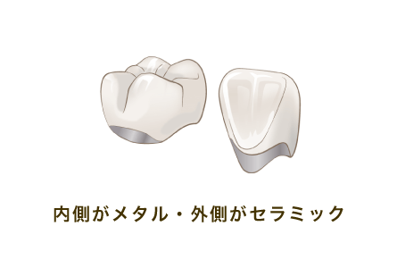 Wクラウン