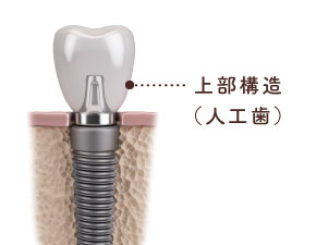 上部構造