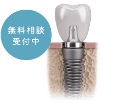無料相談受付中